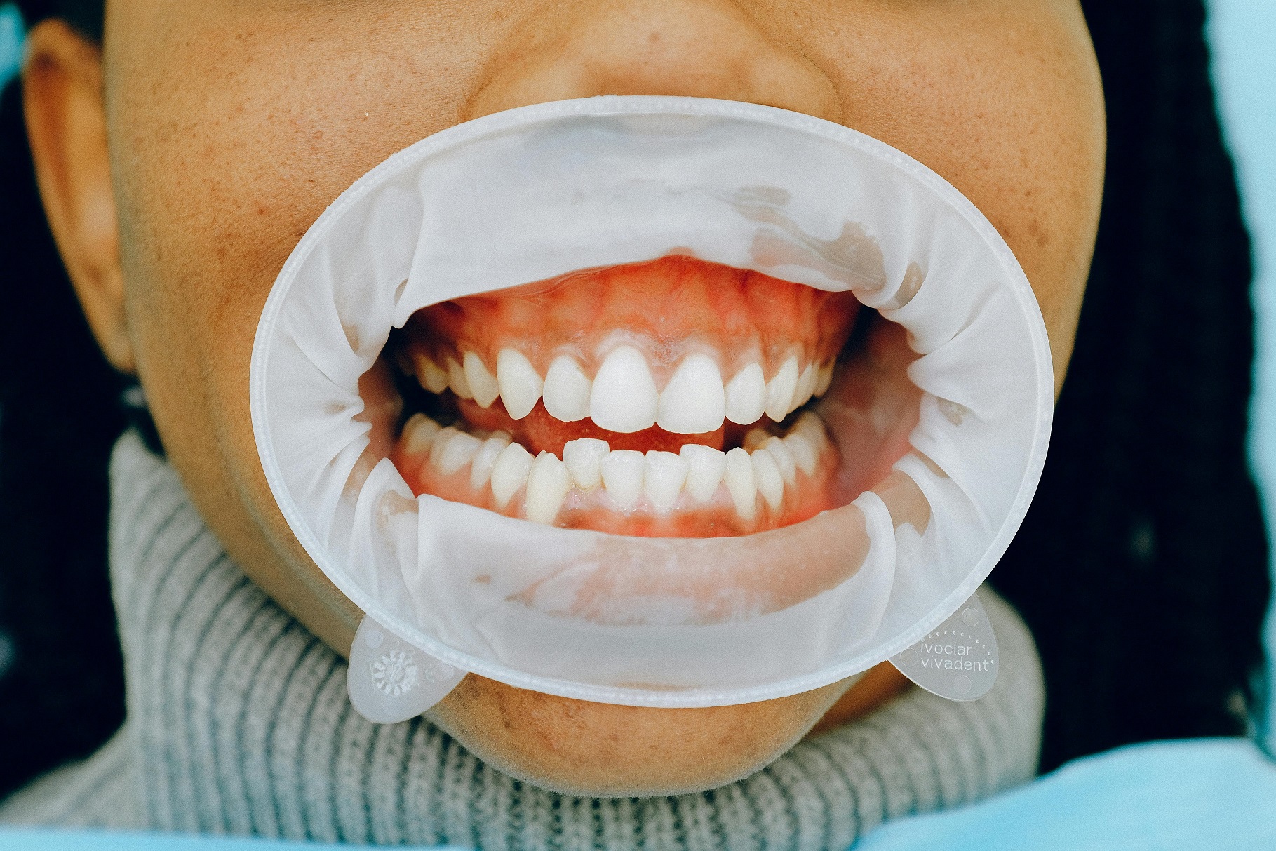 teeth cleaning