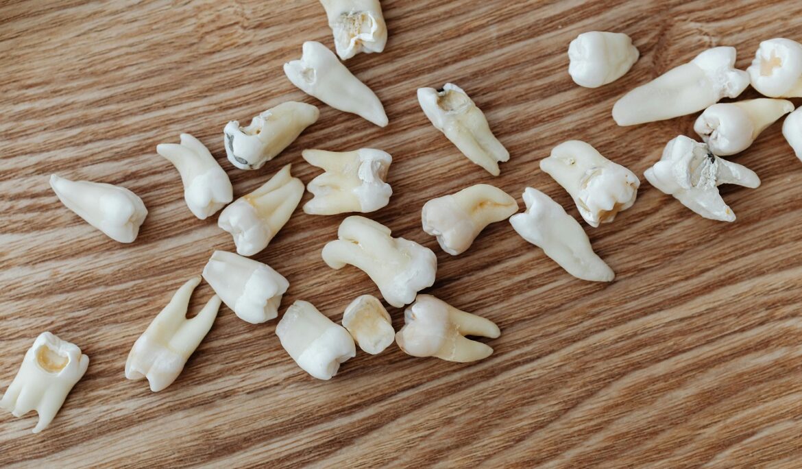 tooth decay treatment