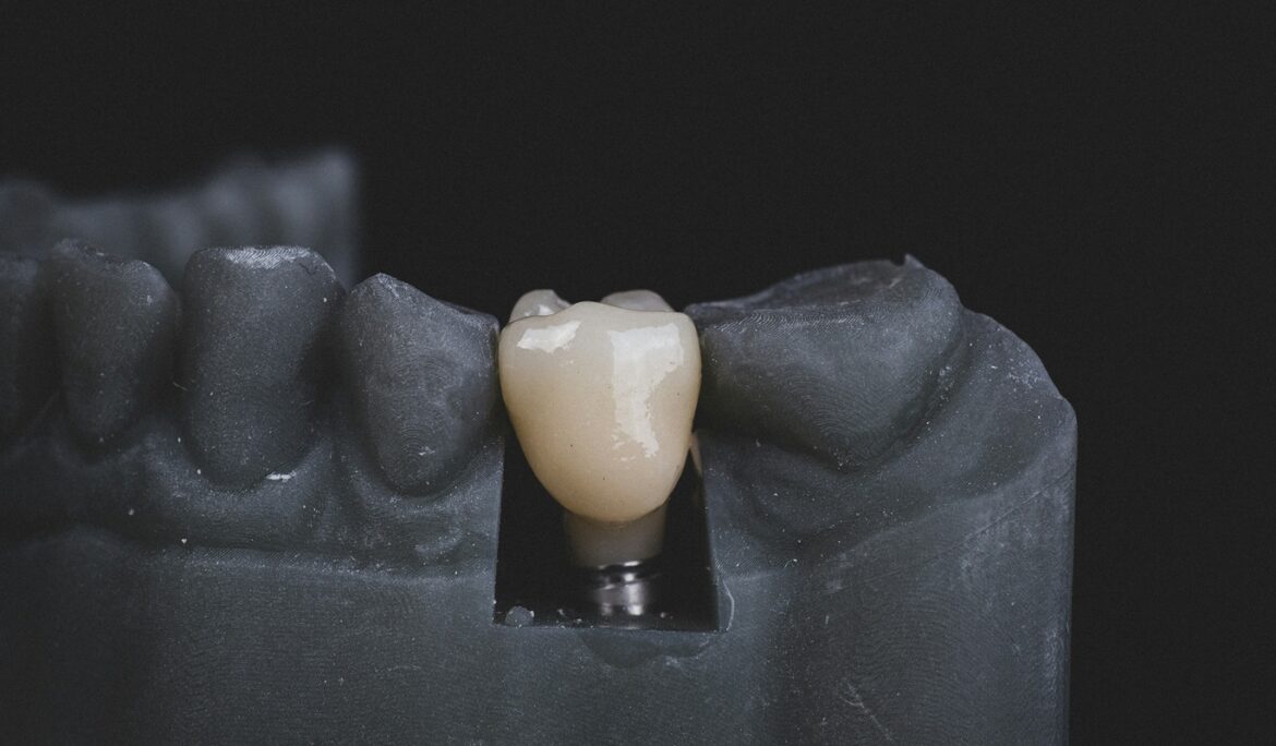 DENTAL CROWNS IN Australia NSW