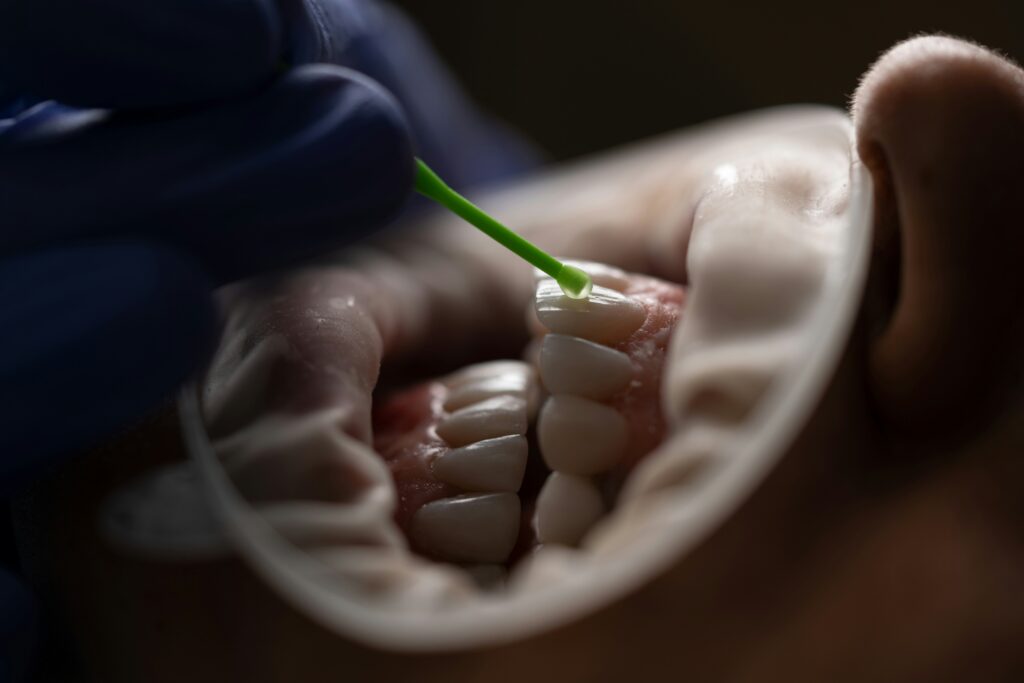 dental filling